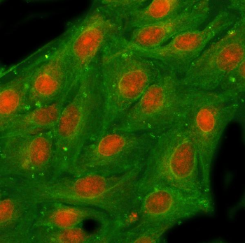 NSFL1C Rabbit Polyclonal Antibody