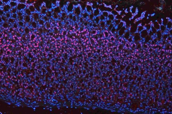 Anti-Musashi 1/Msi1 Antibody Picoband