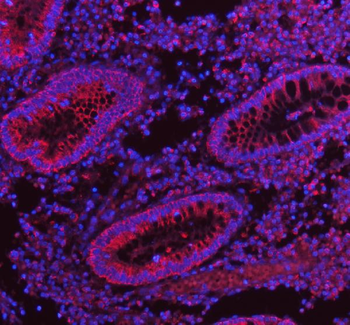 HERP/HERPUD1 Antibody