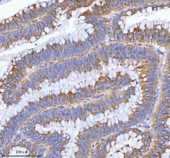 Anti-MLKL Antibody Picoband