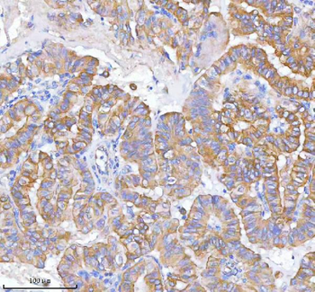 Anti-MLKL Antibody Picoband