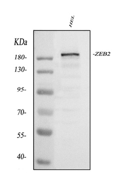 Smad Interacting Protein 1/ZEB2 Antibody