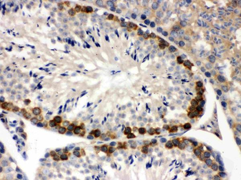 Anti-YB1/YBX1 Antibody