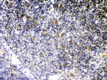 TNF Receptor II/TNFRSF1B Antibody