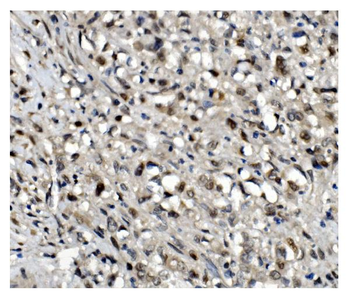 Anti-OGT/O-Linked N-Acetylglucosamine Transferase Antibody