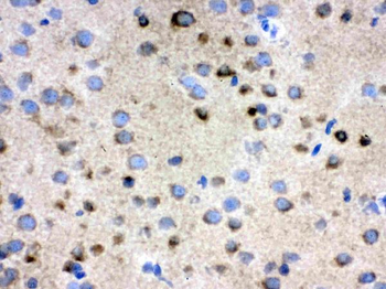 TCP1 delta/CCT4 Antibody