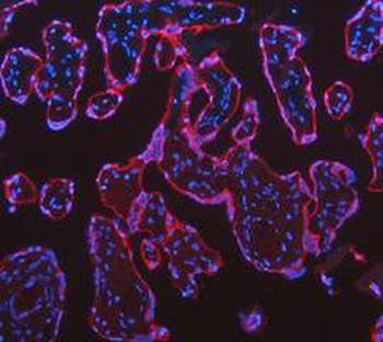 Cytokeratin 18/KRT18 Antibody