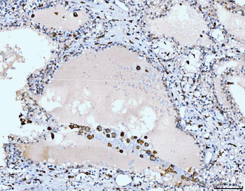 Anti-CD163 Antibody Picoband