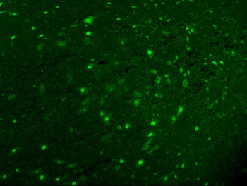 Anti-Calbindin/CALB1 Antibody