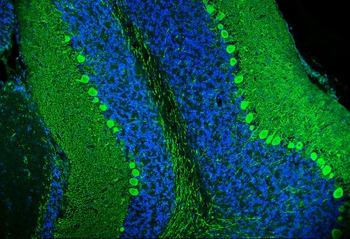 Anti-Calbindin/CALB1 Antibody