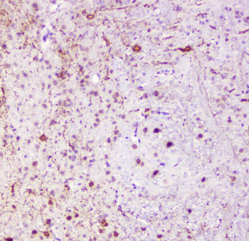 Anti-Calbindin/CALB1 Antibody