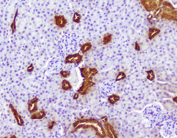 Anti-Calbindin/CALB1 Antibody