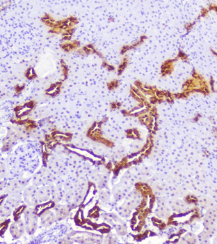 Anti-Calbindin/CALB1 Antibody