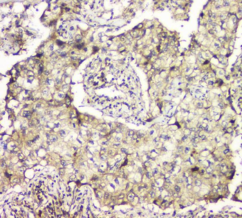 MCUR1 Antibody