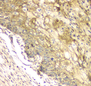 MCUR1 Antibody