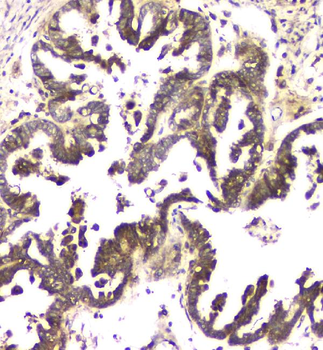 MCUR1 Antibody