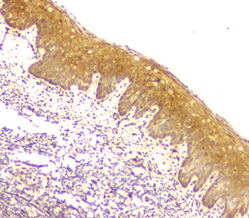 MCUR1 Antibody