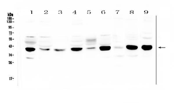 MCUR1 Antibody