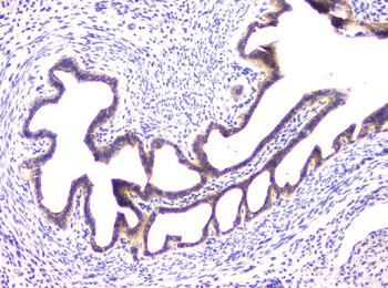 RAB11B Antibody