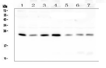 RAB11B Antibody