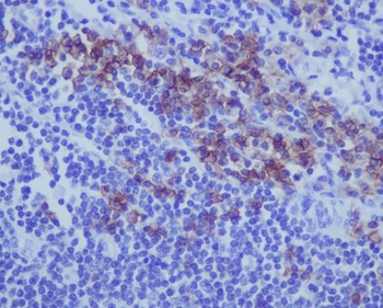 CD38 Rabbit Monoclonal Antibody