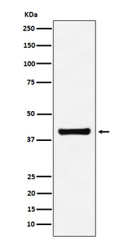 Aldolase ALDOA Monoclonal Antibody