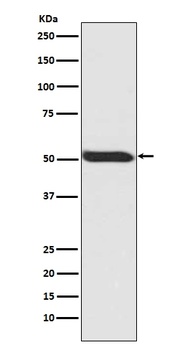 Phospho-p53 (S392) TP53 Rabbit Monoclonal Antibody