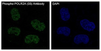 Phospho-POLR2A (S5) Rabbit Monoclonal Antibody