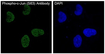 Phospho-c-Jun (S63) Rabbit Monoclonal Antibody