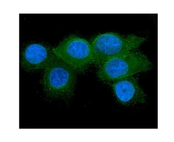 RAB27A Antibody (monoclonal, 2F5)