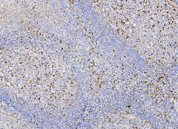 RAB27A Antibody (monoclonal, 2F5)