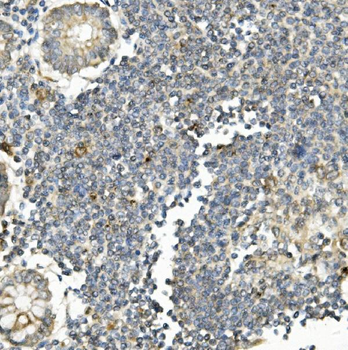 Anti-Bid Antibody (monoclonal, 10F4)