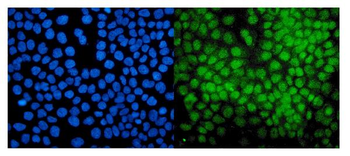E3 SUMO-protein ligase PIAS1 PIAS1 Antibody