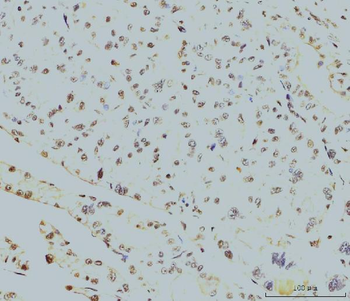 RPA32/RPA2 Antibody (monoclonal, 3B2E9)