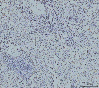 RPA32/RPA2 Antibody (monoclonal, 3B2E9)