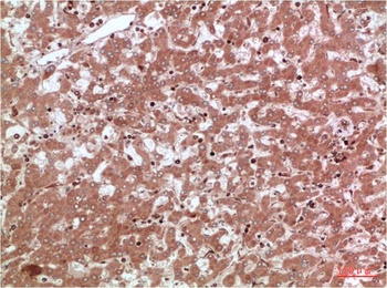 AMPK alpha2 antibody