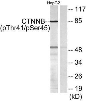 Catenin-beta (phospho-Thr41/S45) antibody