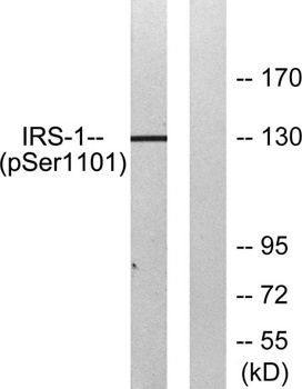 IRS-1 (phospho-Ser1101) antibody