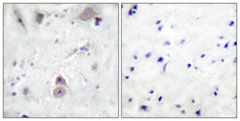 Amyloid-beta (phospho-Thr743) antibody