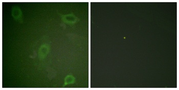 Amyloid-beta (phospho-Thr743) antibody