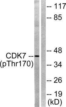 Cdk7 (phospho-Thr170) antibody