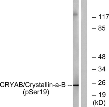 Crystallin-alphaB (phospho-Ser19) antibody