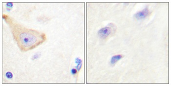 IL-3Rβ (phospho Tyr593) rabbit pAb Antibody