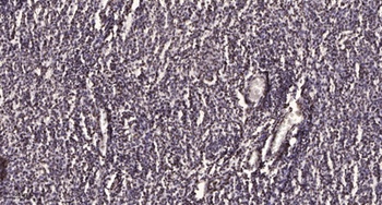 Catenin-beta (phospho-Tyr654) antibody