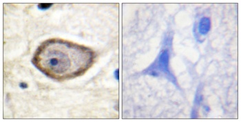TF (phospho-Ser290) antibody