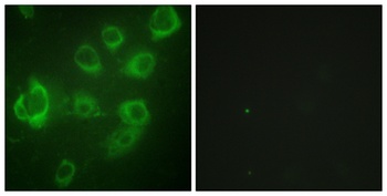 MRLC2 (phospho-Ser18) antibody