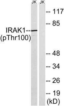 IRAK-1 (phospho-Thr100) antibody