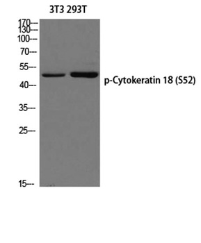 Cytokeratin 18 (phospho Ser52) rabbit pAb