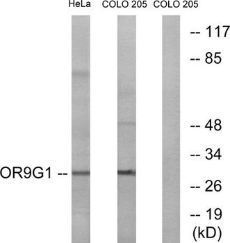 Olfactory receptor 9G1 antibody