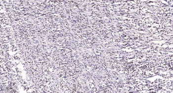 Lamin A/C (phospho-Ser22) antibody